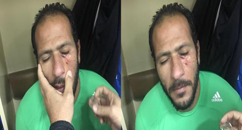 انبي: أحمد علي تعدى بالضرب على حارسنا وننتظر عقابا رادعا